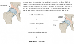 hip joint arthritis progression